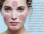 Жирная кожа лица: маски, уход, крем, причины и что делать